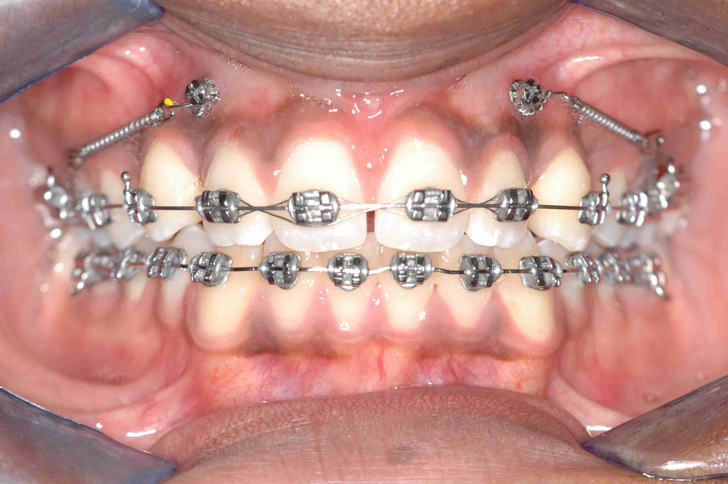 Orthodontie